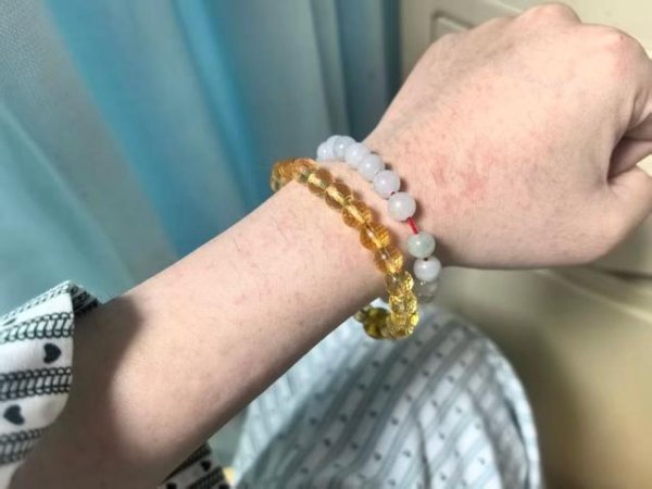 一直牛配资 每天长袖长裤，蚊子到底怎么钻了空子？一位基孔肯雅热患者的自述